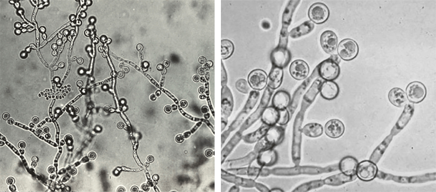 Дрожжеподобные грибы candida. Грибы кандида микроскопия. Бластоспоры кандида. Псевдомицелий кандида.